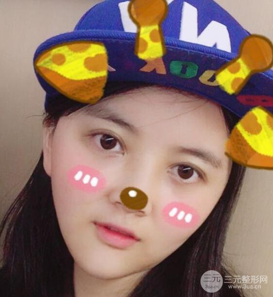 墊下巴恢復(fù)日記