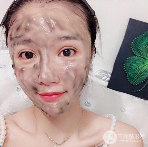 辣媽做了自體脂肪填充全臉，對比圖分享