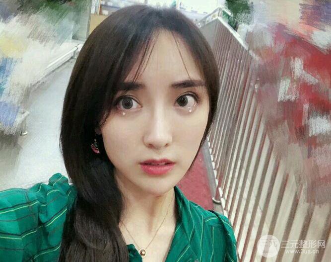 東莞寶格麗韋文奇隆鼻整形果圖分享，對比曝光