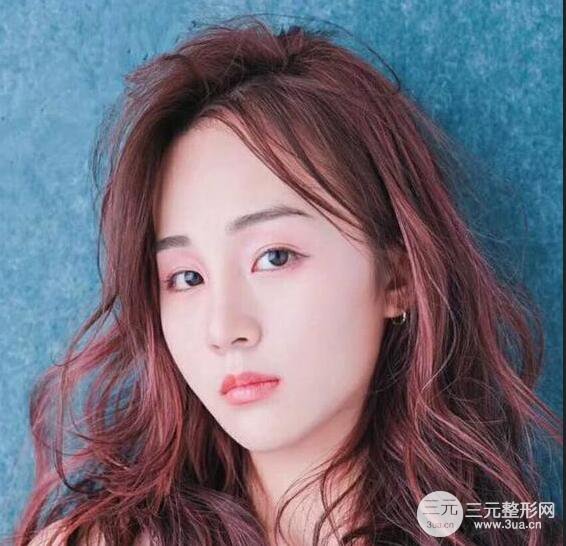 杭州恒顏醫(yī)療美容趙德星隆鼻整形手術(shù)恢復(fù)過(guò)程圖