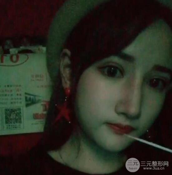 去下頜角+顴骨內(nèi)推手術(shù)三個(gè)月記錄，看大臉妹如何逆襲