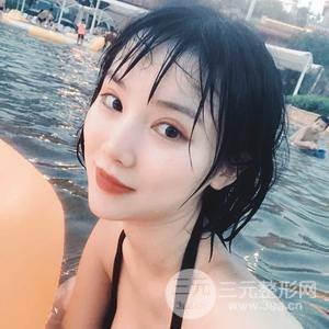 全切雙眼皮半個月恢復(fù)全記錄