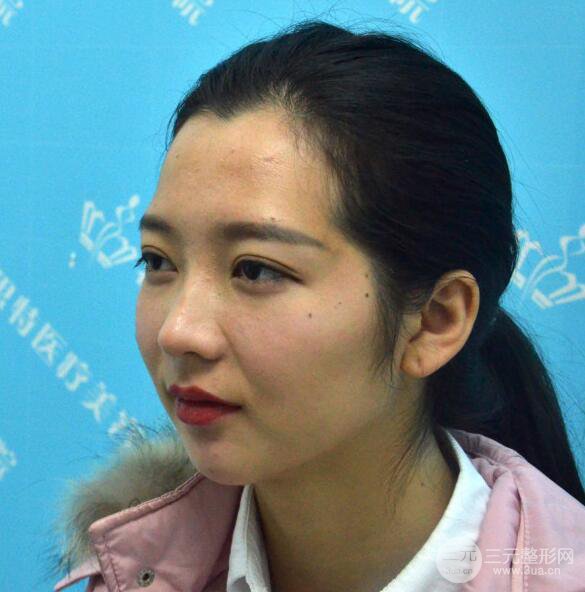 長得太著急是怎樣一種體驗？妹子血淚分享自體脂肪填充詳細部年輕化經(jīng)驗