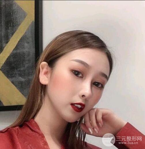 三亞三仁于德印肋軟骨隆鼻+硅膠墊下巴恢復(fù)對比圖