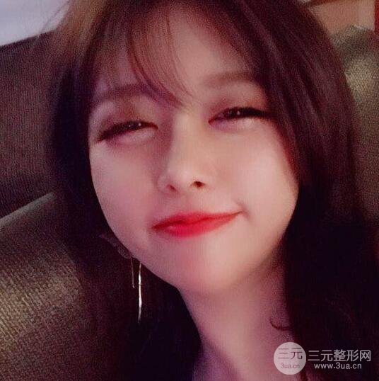 減肥太辛苦了，我還是做個面部吸脂來逆襲