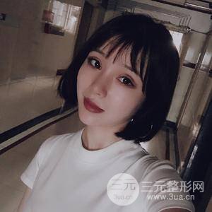 全切雙眼皮半個月恢復(fù)全記錄