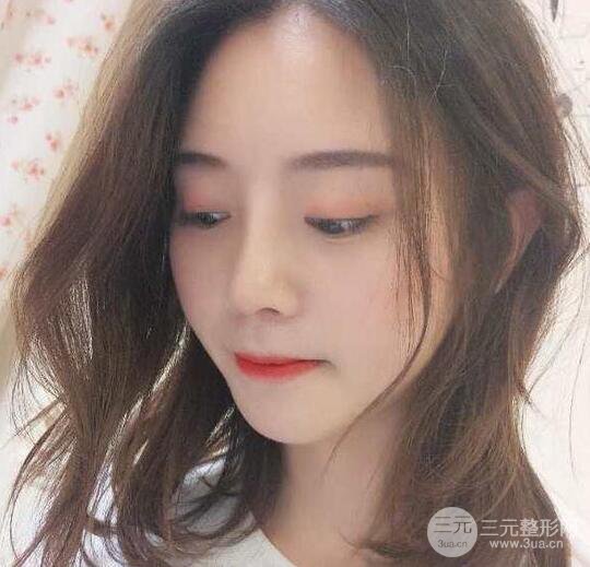 自體軟骨隆鼻恢復(fù)記錄，附對(duì)比圖片