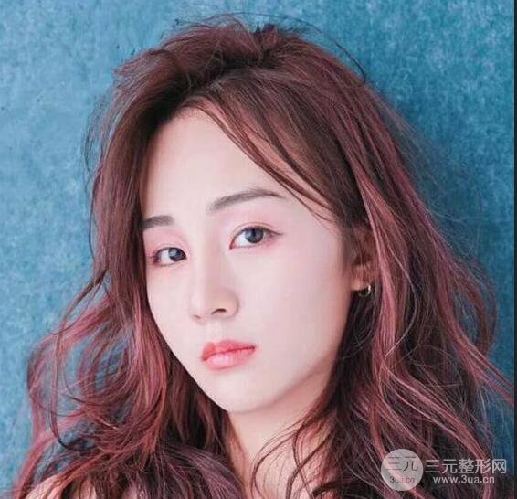 洛陽(yáng)愛(ài)尚醫(yī)療美容王廷金隆鼻整形果圖，恢復(fù)后有點(diǎn)像張鈞甯