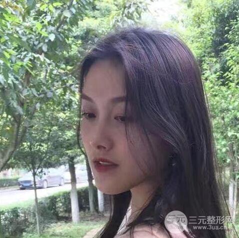 做了“埋埋蛋白線.提升+隆鼻整形”，恢復(fù)后老公說很沒有降低風(fēng)險(xiǎn)感