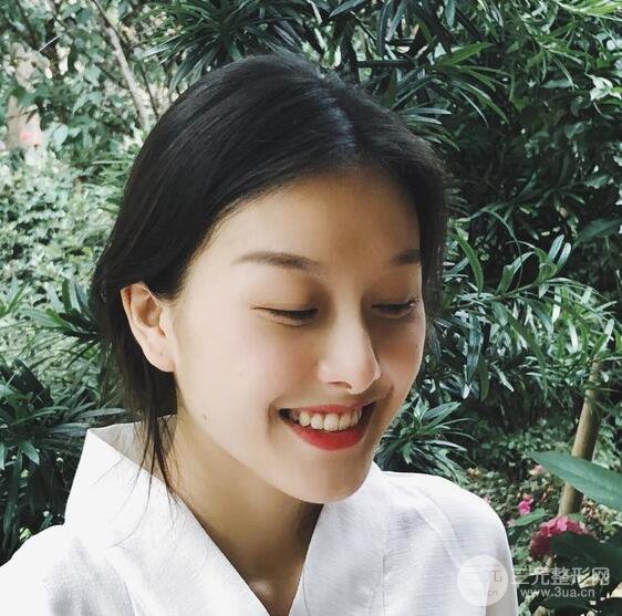 做了“埋埋蛋白線.提升+隆鼻整形”，恢復(fù)后老公說很沒有降低風(fēng)險(xiǎn)感