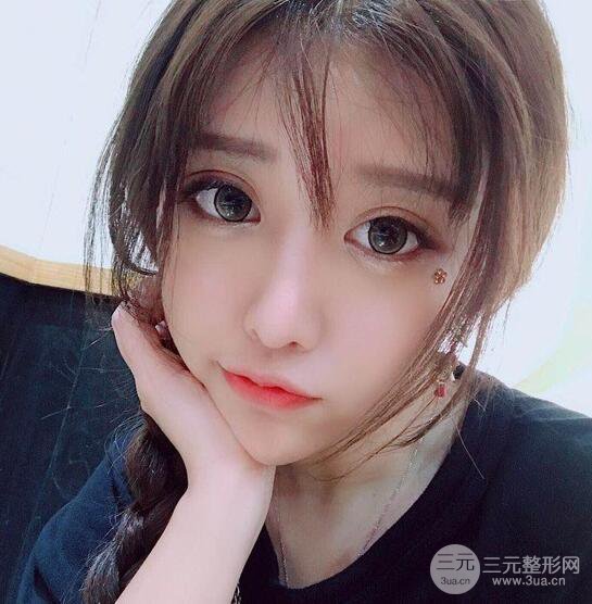 減肥太辛苦了，我還是做個面部吸脂來逆襲