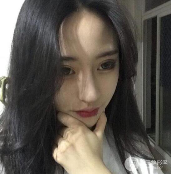 河南中醫(yī)藥大學(xué)第(一)附屬醫(yī)院趙絳波做磨骨怎么樣？看看這位小姐姐的蛻變叭！