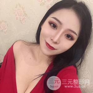 假體隆胸三個月恢復(fù)圖