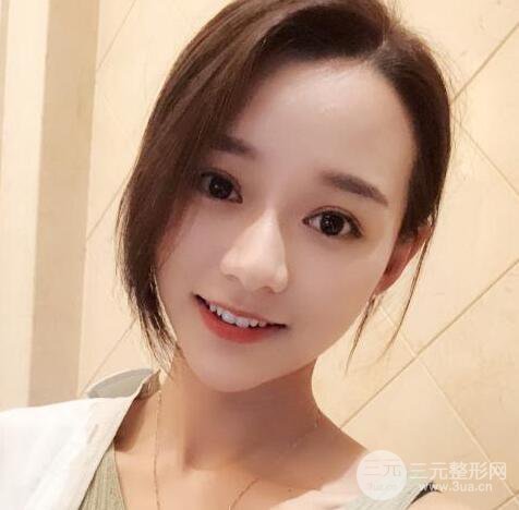 自體脂肪全臉填充三個(gè)月恢復(fù)圖，真實(shí)案例分享