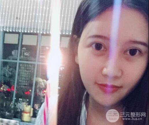 宜昌美岸醫(yī)療美容李英華自體脂肪面部填充怎么樣？真人日記曝光