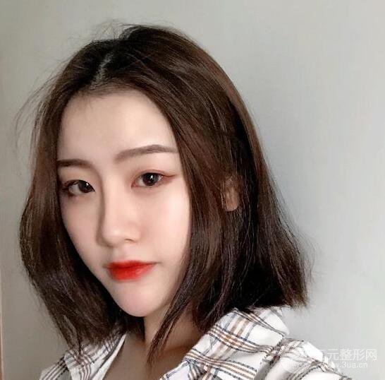 膨體隆鼻三十天恢復(fù)記錄，術(shù)前術(shù)后對比圖片曝光