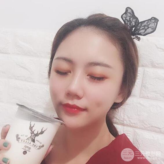 泉州億星閔英俊磨骨恢復(fù)圖分享