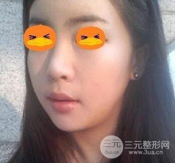 談一談我的磨骨瘦臉經(jīng)歷