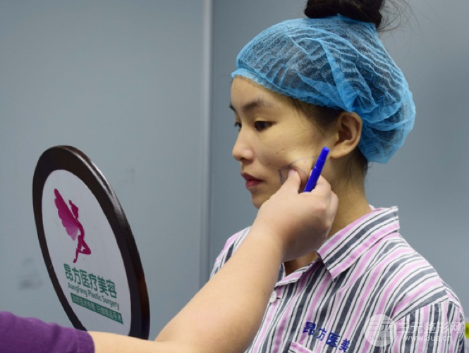 埋埋蛋白線(xiàn).提升恢復(fù)圖，原來(lái)小V臉不一定要磨骨