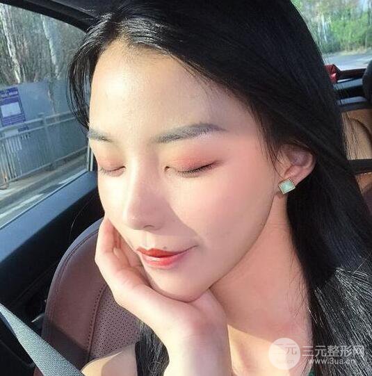 凸嘴先別急著正頜，做個(gè)隆鼻整形會(huì)更美