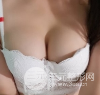 自體脂肪隆胸恢復圖曝光，見證從A到C的蛻變