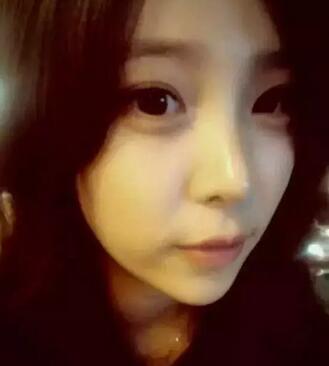 我的假體隆鼻恢復過程,有圖有真相哦~