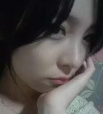 我的假體隆鼻恢復過程,有圖有真相哦~