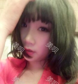 做了切開雙眼皮之后氣質(zhì)都不一樣了