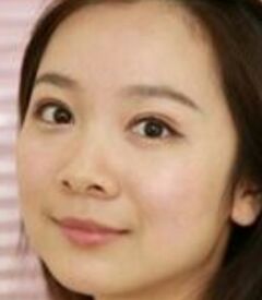 全切雙眼皮讓我眼睛變得更大更有神