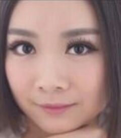 全切雙眼皮讓我眼睛變得更大更有神