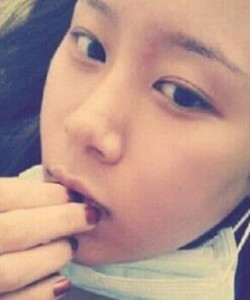 去北京301醫(yī)院整形美容科做了顴骨內(nèi)推大家快來(lái)圍觀啦