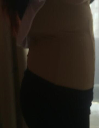 給你們分享麗都醫(yī)生做的吸脂瘦腰腹