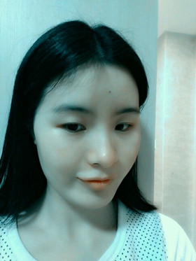 自體脂肪填充下巴前后對比圖，進來看看就知道啦!