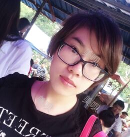 埋埋蛋白線.提升后皮膚緊致了不少也更年輕了