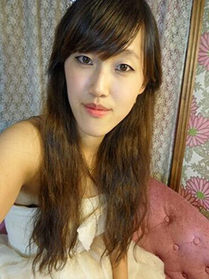 終于做了下頜角磨骨的手術(shù) 北京藝星做的 果還不錯(cuò)