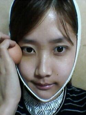 終于做了下頜角磨骨的手術(shù) 北京藝星做的 果還不錯(cuò)