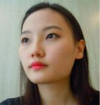 和大家分享北京301醫(yī)院做的下頜角整形真實(shí)經(jīng)歷