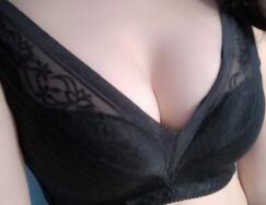 假體隆胸術(shù)后恢復(fù)圖