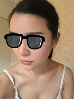 藝美王東做的自體脂肪填充面部，要的就是這個范兒