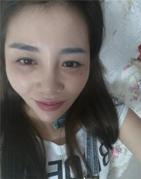 來評價一下華美劉琦做的高強度聚焦超聲吧