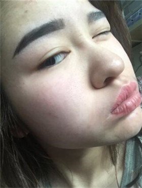 杜姜給我打了水光補(bǔ)水看起來(lái)皮膚嫩嫩的