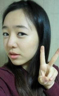 耳軟骨隆鼻前后過(guò)程圖片，見(jiàn)證我變美的過(guò)程