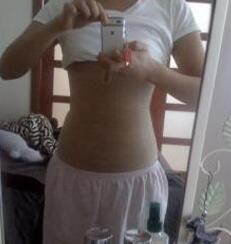 北京禾美嘉腹部吸脂 可以自信地秀出小蠻腰啦！