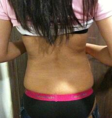 北京禾美嘉腹部吸脂 可以自信地秀出小蠻腰啦！