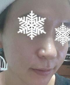 北京禾美嘉彩光嫩膚 果不錯(cuò)哦~