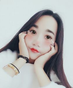 煙臺(tái)鵬愛(ài)魏璐做的全切雙眼皮，我也是大眼美女了