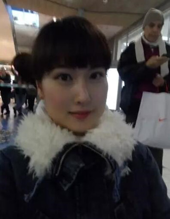 做了下頜角整形手術(shù)北京八大處的技術(shù)真棒