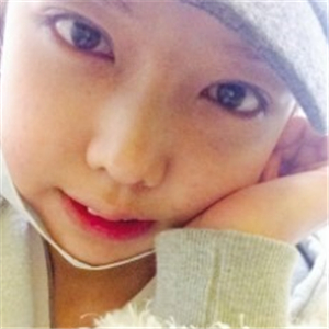 米揚(yáng)麗格夏正義做雙眼皮果怎么樣？看看我的前后對比果圖片吧！