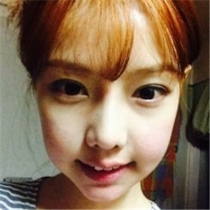 米揚(yáng)麗格夏正義做雙眼皮果怎么樣？看看我的前后對比果圖片吧！