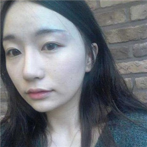 趙雅雄做下頜角整形成好嗎？看看我的前后對(duì)比圖片就知道了~